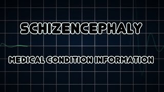 Schizencephaly Medical Condition [upl. by Carrillo]