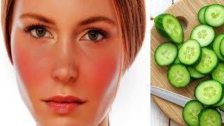 How to Get Rid of Redness on Your Face Using Cucumber  The Benefits of Cucumber [upl. by Los]