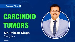 Topic  CARCINOID TUMORS I Dr Pritesh SIngh  Surgery [upl. by Rola373]