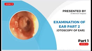 Examination of Ear Part 2 Otoscopy of Ear  ENT Made easy by r Mishi Bhatti  Part 1 [upl. by Klayman490]