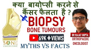 biopsy Biopsy in bonecancer  Myths vs Facts क्या बायोप्सी करने से कैंसर फैलता है Dr Rajat Gupta [upl. by Yrrat720]