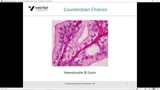 Counterstaining Tips and Caveats in IHC [upl. by Leo744]