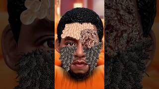 ASMR remove ticks and maggots from Chadwick Boseman Tribute  severely injured treatment [upl. by Essex626]