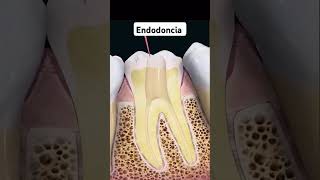 Endodoncia parati fyp endodoncia endo dolordemuela infecciondental viralfypシ [upl. by Bartolemo]