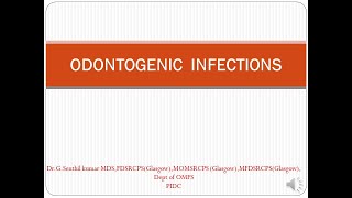 ODONTOGENIC INFECTIONS [upl. by Ariajaj615]