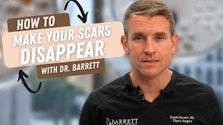 How To Make Your Scars Disappear  Barrett Plastic Surgery [upl. by Karlin]