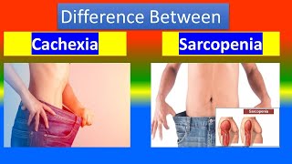 Difference Between Cachexia and Sarcopenia [upl. by Florence311]