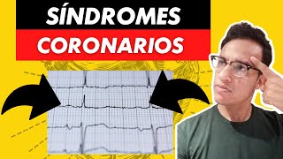 Síndromes coronarios ¿cómo puedo ayudar a mis pacientes SanofiSponsored [upl. by Kcirtapnaes636]