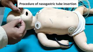 Nasogastric feeding Tube insertion  Ryles Tube  Pediatrics Instruments [upl. by Camella]