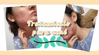 ¿Tratamiento para el acné ¿me funcionó ¿minociclina Parte 2💖  acne [upl. by Wurster]