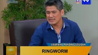 Good Morning Kuya Ringworm  Symptoms and Treatment [upl. by Kiki]