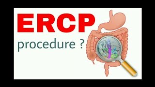 What is ERCP Procedure  deeply Explain about Endoscopy retrograde colangiopancreatography [upl. by Enellek]