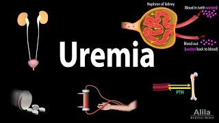 Uremia Pathophysiology Symptoms Diagnosis and Treatment Animation [upl. by Dlorad]