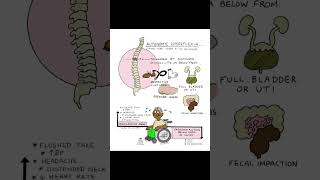 Automatic dysreflexia nursing nursingexam nclexreview [upl. by Carolyne]