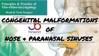 CONGENITAL MALFORMATIONS OF NOSE AND PARANASAL SINUSES PART2 [upl. by Mattie]