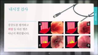 헬스 amp 라이프소화기 위장질환 다스리기3역류성식도염2  소화기내과 이준행 교수의료진 ON Line 강의 [upl. by Adile]