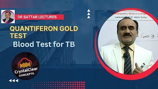 Quantiferon Gold TB Test  A Blood Serum test for TB Diagnosis [upl. by Pillihp]