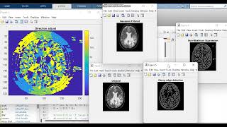 Canny edge detection in Matlab code to detect edges  Edge detection matlab [upl. by Leinahtam]