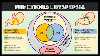 DYSPEPSIA 4TH YR [upl. by Bruyn320]