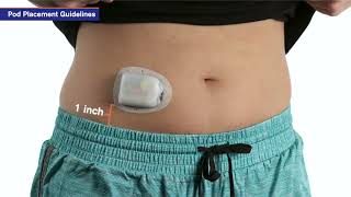 Insulin Pump Training Omnipod DASH®  How to select a Pod placement site [upl. by Shirline]