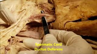 INGUINAL CANAL and Abdominal Ventral HERNIAS – Sanjoy Sanyal [upl. by Eilrahc]