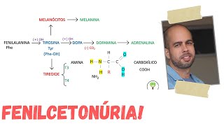 FENILCETONÚRIA  PKU  e METABOLISMO DA FENILALANINA ENEM [upl. by Elias]