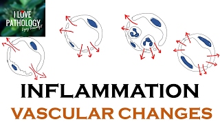 INFLAMMATION Part 1 General concepts types  Vascular changes in Acute inflammation [upl. by Rabkin]