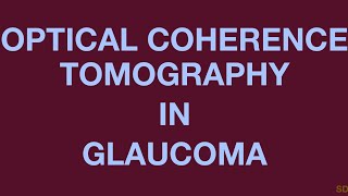 Glaucoma Session 10 Posterior Segment Imaging [upl. by Selry882]