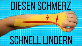 Soforthilfe mit TAPE bei Unterarmschmerzen DeQuervain Tendinitis  Test [upl. by Nohtanoj]