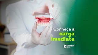 Carga imediata agiliza os implantes dentários [upl. by Petula]