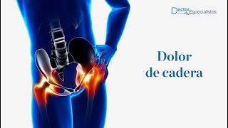 Dolor de cadera  Doctores Especialistas [upl. by Torrie]