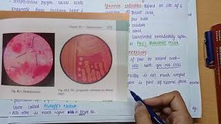 Streptococcus Pyogenes  Morphology  Virulence factors  culture amp lab diagnosis  MICROBIOLOGY [upl. by Skipp927]