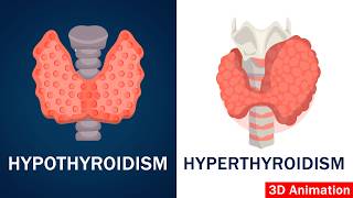 Hypothyroidism vs Hyperthyroidism Explained thyroid [upl. by Utter570]