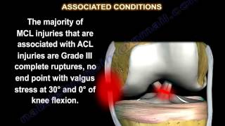 Medial Collateral Ligament injury  MCL Injuries  Everything You Need To Know  Dr Nabil Ebraheim [upl. by Nitsirhc]