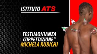 Coppettazione® ATS  Testimonianza Michela Rubichi [upl. by Akoek]