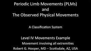 Level 4 Periodic Limb Movements Example [upl. by Okoy]