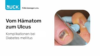 Diabetischer Fuß  vom Hämatom zum Ulcus  Fallbeispiel [upl. by Eelrihs]