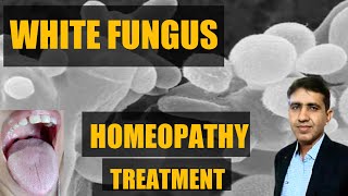 How To Heal Your Body with White Fungus Homeopathy [upl. by Berger]