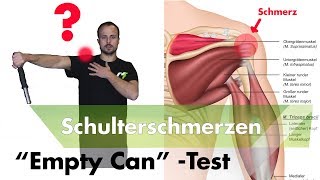 Schulterimpingement Testen  Supraspinatussehne Entzündet [upl. by Arocahs600]