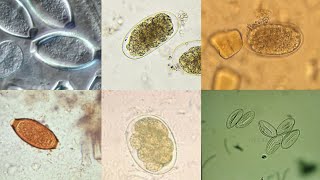 Clinical Parasitology Laboratory  Intestinal Nematode Egg Identification [upl. by Clintock41]