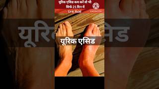 Uric Acid ka ilaj  How to reduce Uric Acid  Uric Acid Treatment shorts short ayurveda ytshort [upl. by Prince753]