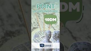 POINT D’ACUPUNCTURE  10DM  Ling Tai acupuncture acupuncturepoints medecinechinoise [upl. by Amalburga]