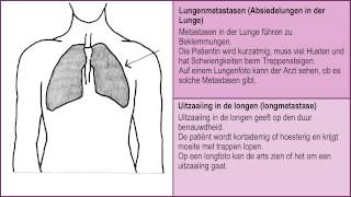 Wenn man nicht mehr gesund wird  Metastasen in Knochen Lunge Leber und Gehirn 26 [upl. by Vanzant817]