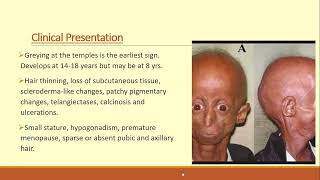 Lecture146 Genetic disorders of Collagen Elastin and Dermal matrix Part II [upl. by Akcirehs]