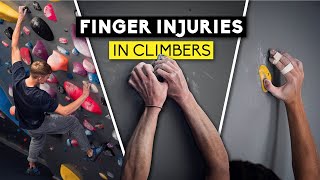 Finger Injuries in Climbers  Lattice Training X Sheffield Climbing Clinic  Part 1 [upl. by Behnken326]