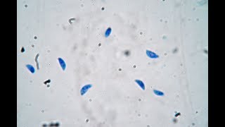 Toxoplasma gondii  live trophozoites [upl. by Elwyn]