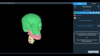 AIbased segmentation and 3D modelling for Maxillofacial Surgical Applications [upl. by Asirac]