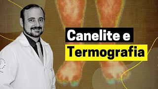 Canelite e Termografia  José Góes [upl. by Musa]