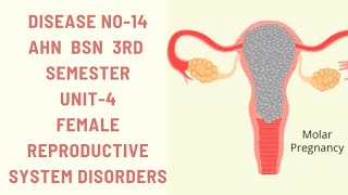 Hydatidiform MoleMolar pregnencyDisease14AHNBSN 3rdsemester Unit4female reproductive disorders [upl. by Christiansen211]