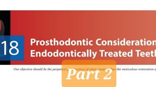 Prosthodontic Considerations in RCT Treated Teeth 2Factors affecting post selectionTypes of Posts [upl. by Heeley]